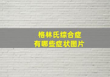 格林氏综合症有哪些症状图片